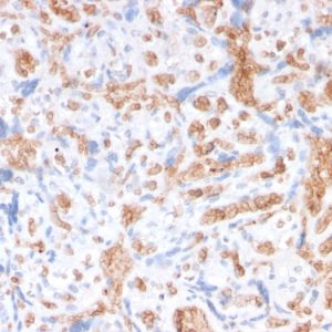 Formalin-fixed, paraffin-embedded human Placenta stained with Spectrin alpha 1 Mouse Recombinant Monoclonal Antibody (rSPTA1/1832).