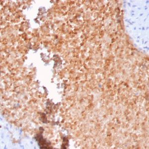 Formalin-fixed, paraffin-embedded human lung stained with Fodrin Mouse Monoclonal Antibody (SPTAN1/3352).