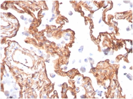 Formalin-fixed, paraffin-embedded human lung stained with Fodrin, alpha Mouse Monoclonal Antibody (SPTAN1/3505).