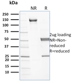 SDS-PAGE Analysis of Purified Spectrin beta III Mouse Monoclonal Antibody (RG/26). Confirmation of Purity and Integrity of Antibody.