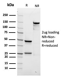SDS-PAGE Analysis of Purified SPTBN2 Recombinant Mouse Monoclonal Antibody (rSPTBN2/1778). Confirmation of Purity and Integrity of Antibody.