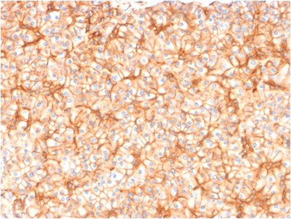 Formalin-fixed, paraffin-embedded human Pancreas stained with Spectrin beta III Mouse Monoclonal Antibody (SPTBN2/1582).