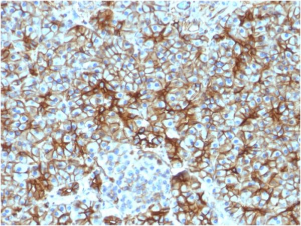 Formalin-fixed, paraffin-embedded human Pancreas stained with Spectrin beta III Monoclonal Antibody (SPTBN2/1583).