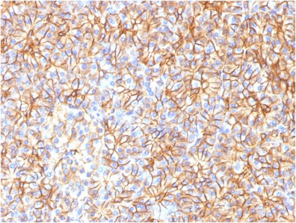 Formalin-fixed, paraffin-embedded human Pancreas stained with Spectrin beta III Monoclonal Antibody (SPTBN2/1584).