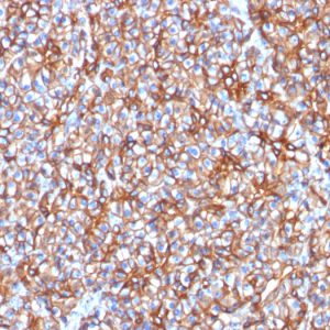 Formalin-fixed, paraffin-embedded human pancreas stained with Spectrin beta III Mouse Monoclonal Antibody (SPTBN2/1778).