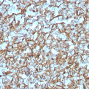 Formalin-fixed, paraffin-embedded human Pancreas stained with Spectrin beta III Recombinant Rabbit Monoclonal (SPTBN2/3142R).