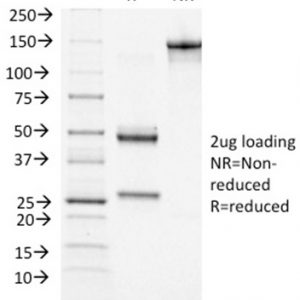 SDS-PAGE Analysis of Purified BRCA1 Mouse Monoclonal Antibody (BRCA1/1472). Confirmation of Integrity and Purity of Antibody.