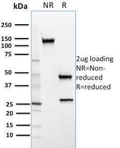SDS-PAGE Analysis of Purified SREBP2 Mouse Monoclonal Antibody (SREBP2/1579). Confirmation of Purity and Integrity of Antibody.