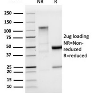 SDS-PAGE Analysis of Purified StARRecombinant Rabbit Monoclonal Antibody (STAR/3915R). Confirmation of Purity and Integrity of Antibody.