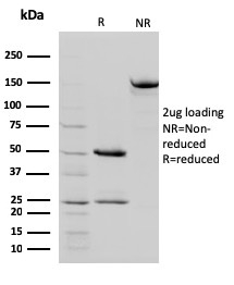 SDS-PAGE Analysis of Purified STAT5B Mouse Monoclonal Antibody (STAT5B/2657). Confirmation of Integrity and Purity of Antibody.