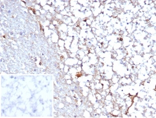 Formalin-fixed, paraffin-embedded human cerebellum stained with STAT6 Recombinant Rabbit Monoclonal Antibody (STAT6/7163R). Inset: PBS instead of primary antibody; secondary only negative control.