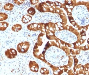 Formalin-fixed, paraffin-embedded human small intestine stained with SULT1E1 Mouse Monoclonal Antibody (CPTC-SULT1E1-1).