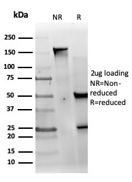 SDS-PAGE Analysis of Purified MED22 Mouse Monoclonal Antibody (PCRP-MED22-1E4). Confirmation of Purity and Integrity of Antibody.