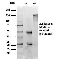 SDS-PAGE Analysis of Purified MED22 Mouse Monoclonal Antibody (PCRP-MED22-2A7). Confirmation of Purity and Integrity of Antibody.