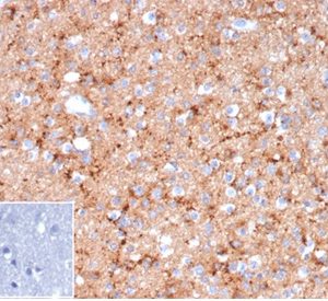 Formalin-fixed, paraffin-embedded human brain stained with rSYP/6856 at 2ug/ml. HIER: Tris/EDTA, pH9.0, 45min. 2°C: HRP-polymer, 30min. DAB, 5min. Inset: PBS instead of primary. Secondary antibody negative control.
