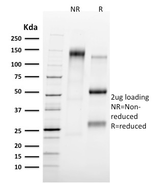 SDS-PAGE Analysis of Purified Tal1 Mouse Monoclonal Antibody (TAL1/2707). Confirmation of Integrity and Purity of Antibody.