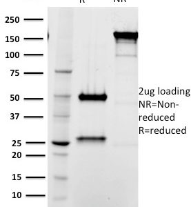 SDS-PAGE Analysis of Purified Tal1 Mouse Monoclonal Antibody (BTL73). Confirmation of Integrity and Purity of Antibody.