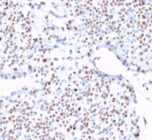 Formalin-fixed, paraffin-embedded human bladder stained with TCF4 Mouse Monoclonal Antibody (TCF4/1705) at 2ug/ml. HIER: Tris/EDTA, pH9.0, 45min. 2°C: HRP-polymer, 30min. DAB, 5min.