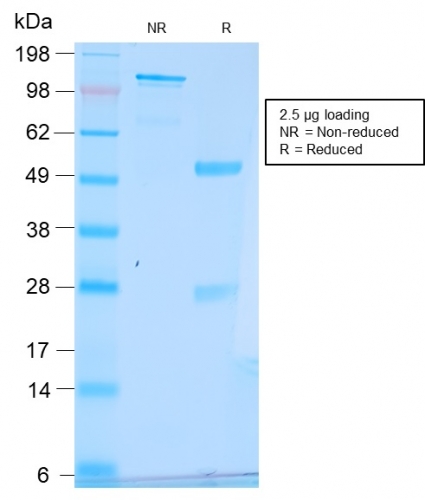 SDS-PAGE Analysis Purified pS2 Rabbit Recombinant Monoclonal Antibody (TFF1/2969R). Confirmation of Purity and Integrity of Antibody.