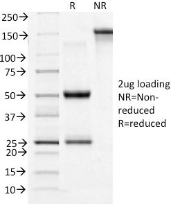 SDS-PAGE Analysis of Purified CD71 Mouse Monoclonal Antibody (TFRC/1396). Confirmation of Integrity and Purity of Antibody.
