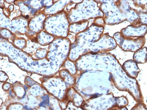 Formalin-fixed, paraffin-embedded human Placenta stained with CD71 Monoclonal Antibody (TFRC/1818).