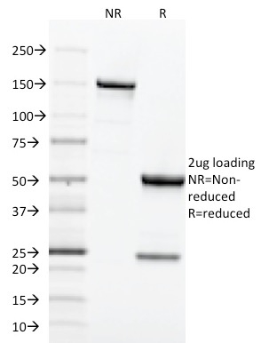 SDS-PAGE Analysis of Purified CD71 Mouse Monoclonal Antibody (TFRC/1818).