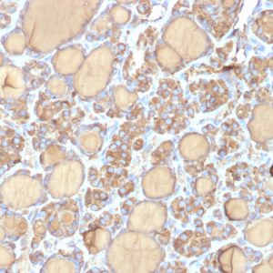 Formalin-fixed, paraffin-embedded human Thyroid stained with Thyroglobulin Mouse Recombinant Monoclonal Antibody (r6E1).