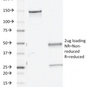 SDS-PAGE Analysis of Purified TGF beta Mouse Monoclonal Antibody (TGFB/510). Confirmation of Purity and Integrity of Antibody.