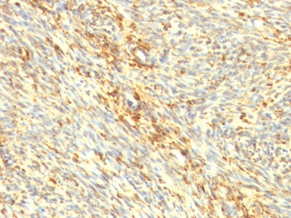 Formalin-fixed, paraffin-embedded human uterus stained with Transglutaminase II Mouse Monoclonal Antibody (TGM2/419).