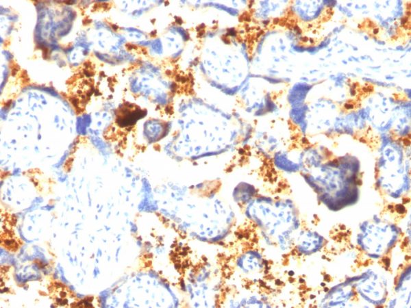 Formalin-fixed, paraffin-embedded human Placenta stained with Transglutaminase II Mouse Monoclonal Antibody (SPM358).