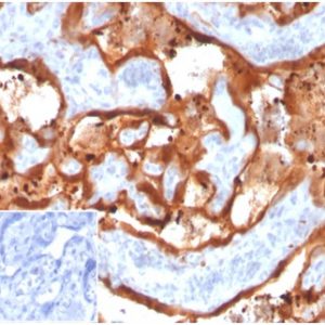 Formalin-fixed, paraffin-embedded human placenta stained with Transglutaminase II Mouse Monoclonal Antibody (TGM2/3612). Inset: PBS instead of primary antibody; secondary only negative control.