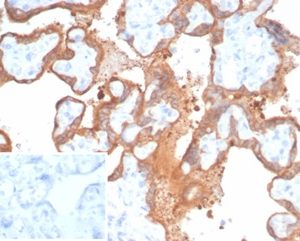Formalin-fixed, paraffin-embedded human placenta stained with Transglutaminase 2 Recombinant Rabbit Monoclonal Antibody (TGM2/6943R). Inset: PBS instead of primary antibody; secondary only negative control.