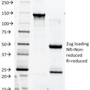 SDS-PAGE Analysis of Purified CD90 Mouse Monoclonal antibody (F15-42-1). Confirmation of Purity and Integrity of Antibody.