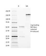 SDS-PAGE Analysis of Purified CD90 Mouse Monoclonal antibody (AF-9). Confirmation of Purity and Integrity of Antibody.