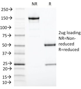 SDS-PAGE Analysis of Purified TIA1 Monoclonal Antibody (TIA1/1313). Confirmation of Purity and Integrity of Antibody.