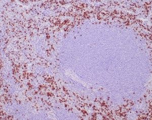 Formalin-fixed, paraffin-embedded human spleen stained with TIA-1 Recombinant Rabbit Monoclonal Antibody (TIA/1352R). HIER: Tris/EDTA, pH9.0, 45min. 2°C: HRP-polymer, 30min. DAB, 5min.