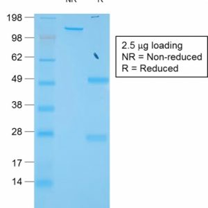SDS-PAGE Analysis of Purified TIMP1 Rabbit Recombinant Monoclonal Antibody (TIMP1/1944R).