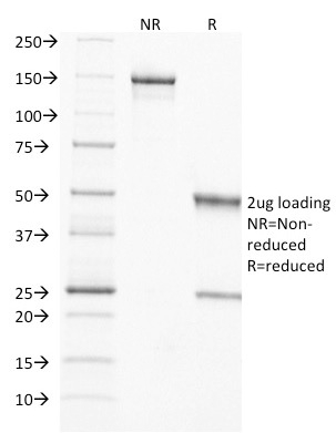 SDS-PAGE Analysis of Purified TIMP2 Mouse Monoclonal Antibody (3A4). Confirmation of Purity and Integrity of Antibody.