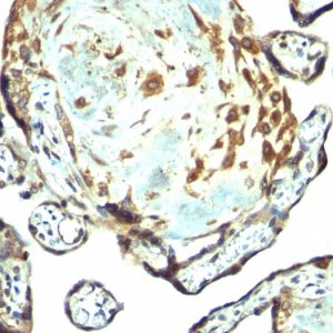 Formalin-fixed, paraffin-embedded human placenta stained with TIMP3 Rabbit PAb.
