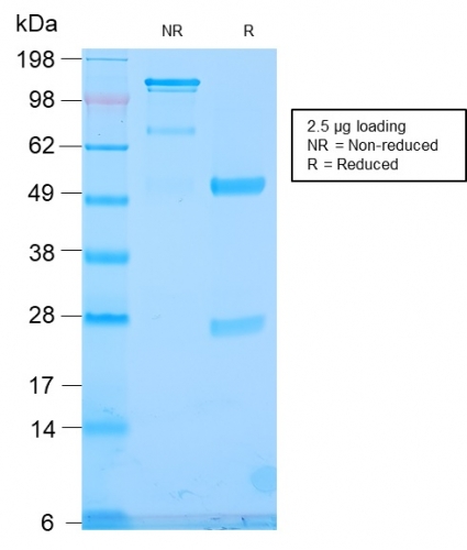 SDS-PAGE Analysis Purified TLE1 Rabbit Recombinant Monoclonal Antibody (TLE1/2946R). Confirmation of Integrity and Purity of Antibody.
