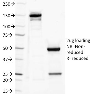 SDS-PAGE Analysis Purified CD282 Mouse Monoclonal antibody (TLR2/221). Confirmation of Purity and Integrity of Antibody.