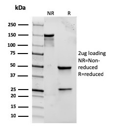 SDS-PAGE Analysis Purified CD282 Recombinant Mouse Monoclonal antibody (rTLR2/221). Confirmation of Purity and Integrity of Antibody.