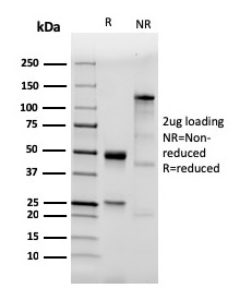 SDS-PAGE Analysis Purified CD282 Recombinant Rabbit Monoclonal antibody (TLR2/3894R). Confirmation of Purity and Integrity of Antibody.