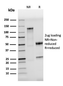 SDS-PAGE Analysis of Purified CD284 Recombinant Rabbit Monoclonal Antibody (TLR4/3895R). Confirmation of Integrity and Purity of Antibody.