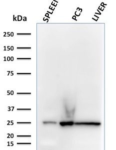 Western Blot Analysis of human spleen, PC3 and liver lysates using C1QA Mouse Monoclonal Antibody (C1QA/2783).