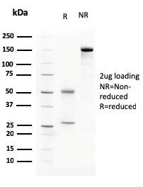 SDS-PAGE Analysis of Purified C1QA Mouse Monoclonal Antibody (C1QA/2783). Confirmation of Purity and Integrity of Antibody. C1QA / Complement C1q A-Chain Antibody - Image 3