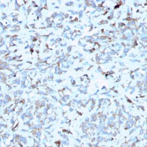 Formalin-fixed, paraffin-embedded human Kidney stained with C1QA Mouse Monoclonal Antibody (C1QA/2952).