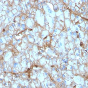 Formalin-fixed, paraffin-embedded human Kidney stained with C1QA Mouse Monoclonal Antibody (C1QA/2954).