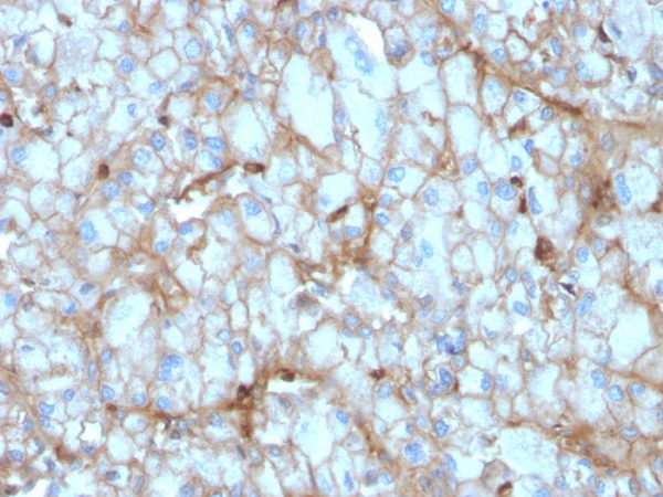 Formalin-fixed, paraffin-embedded human Kidney stained with C1QA Mouse Monoclonal Antibody (C1QA/2954).