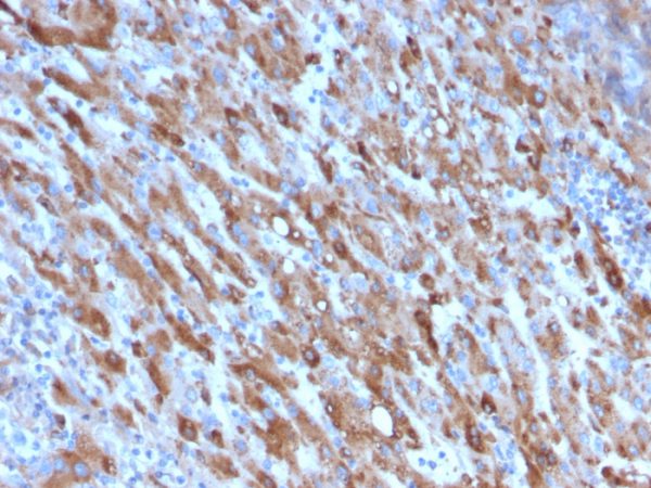 Formalin-fixed, paraffin-embedded human Liver stained with C1QA Mouse Monoclonal Antibody (C1QA/2954).